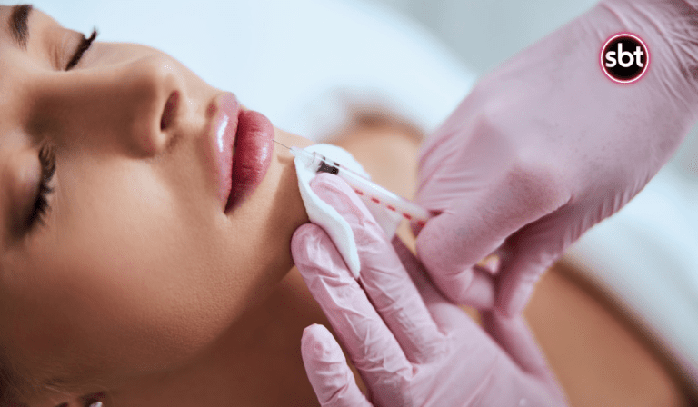 The Art of the Pout: Lip Fillers as a Fashion Statement